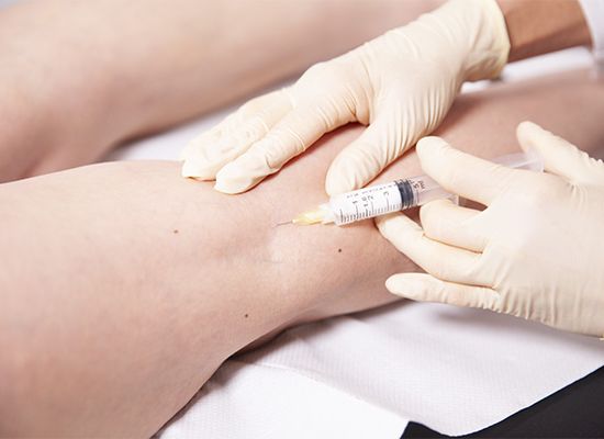 Venenverödung Hautarzt Oberland