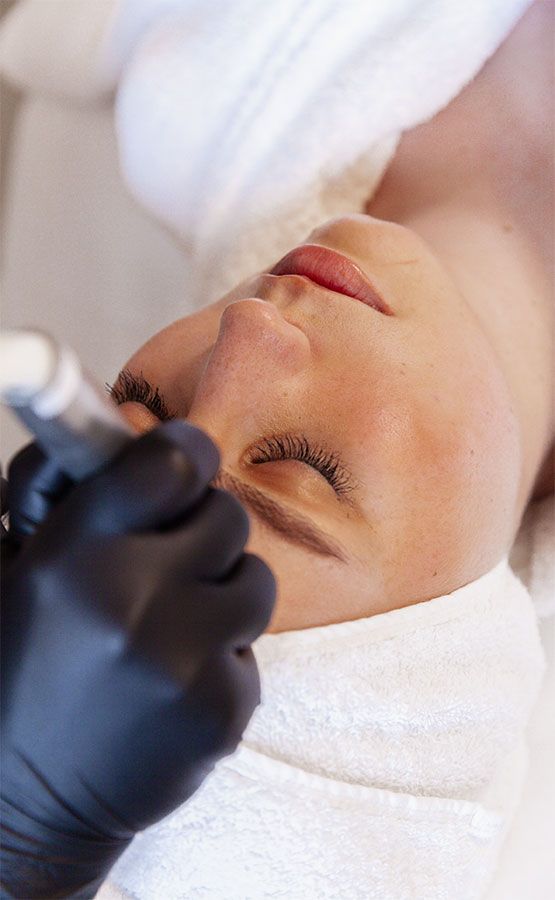 Microdermabrasion