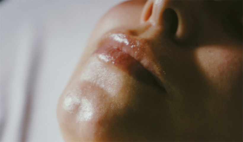 Hyaluron Hautarzt München Umland