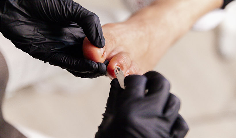 Medizinische Fußpflege